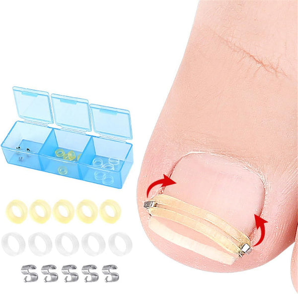 Ingrown Toenail Corrector, Stainless Steel Curved Toenail Straightener with Rubber Bands, Ingrown Toenail Removal Kit, Professional Ingrown Toenail Pedicure Tools for Men Women Curved Nail Repair