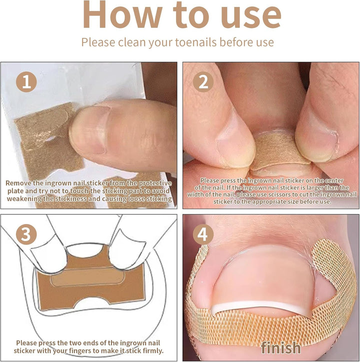 2 Types Ingrown Toenail Treatment Patch with Ingrown Toenail Tool for Toenail Care Protect Toe Nail