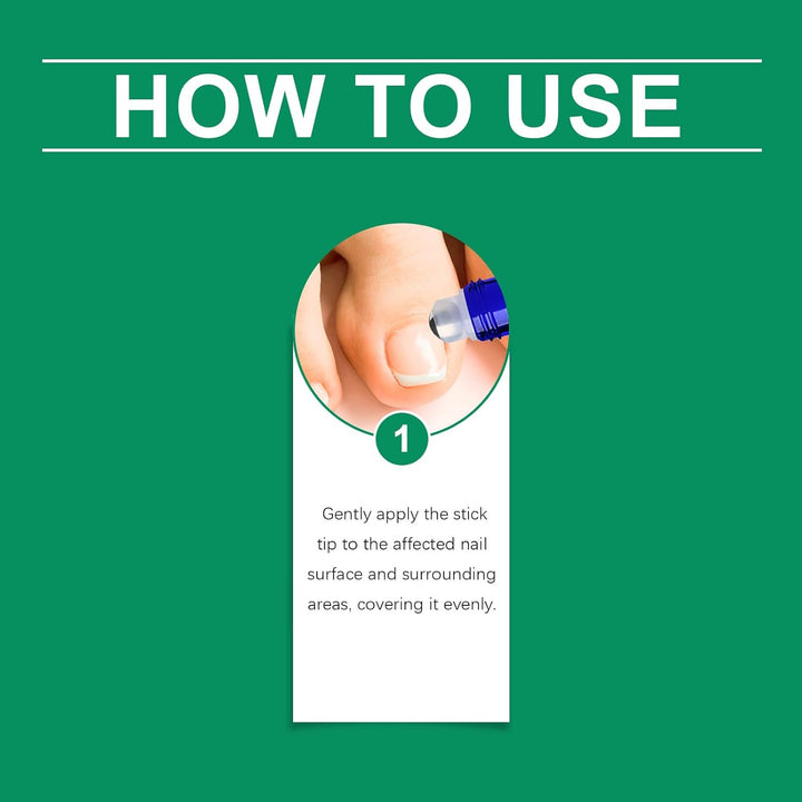 Nailshield anti Fungal Stick, Nail Shield anti Fungal Stick, Natural Nail Strengthener for Damaged Nails