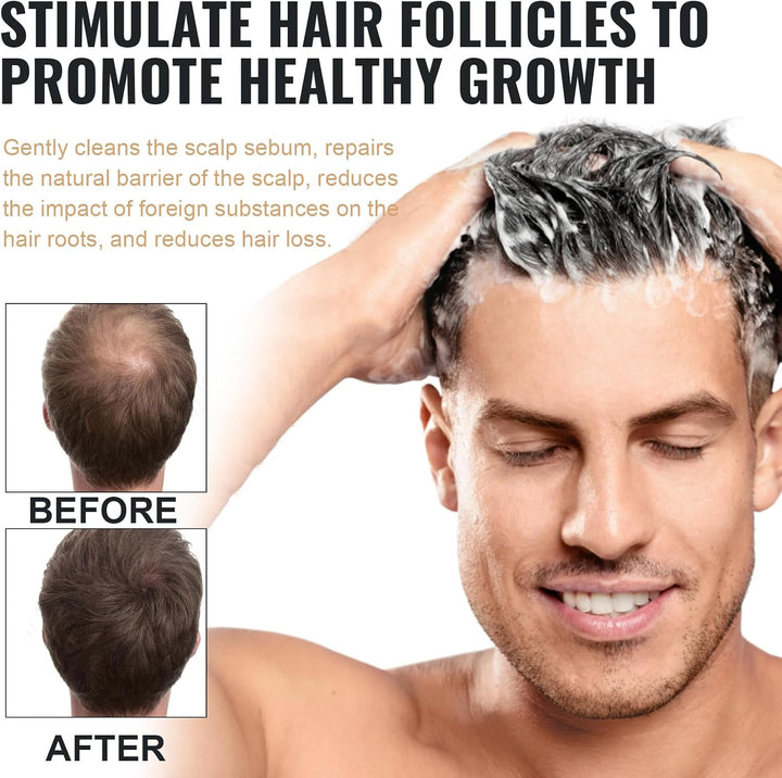 2Pcs Root Activator Shampoo,Mane Root Activator Shampoo for Man,Unisex Hair Thickeningshampoo That Repairs,Smooths & Strengthens,Hair Restoration Solution