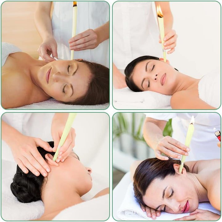 Ear Candles, 10 Pcs Natural Beeswax Ear Candles, 100% Non-Toxic Cylinders Fragrance Hollow Candles, Ear Wax Remover Candle Kit for Blocked Ears (Beige-1Op)