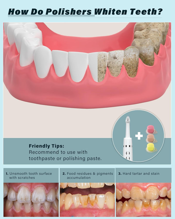 Tooth Polisher,  Teeth Whitening Kit with 5 Modes for Plaque Stain Removal Yellow Teeth, Teeth Polisher Stain Remover with 5 Heads & 3 Polishing Paste, Rechargeable