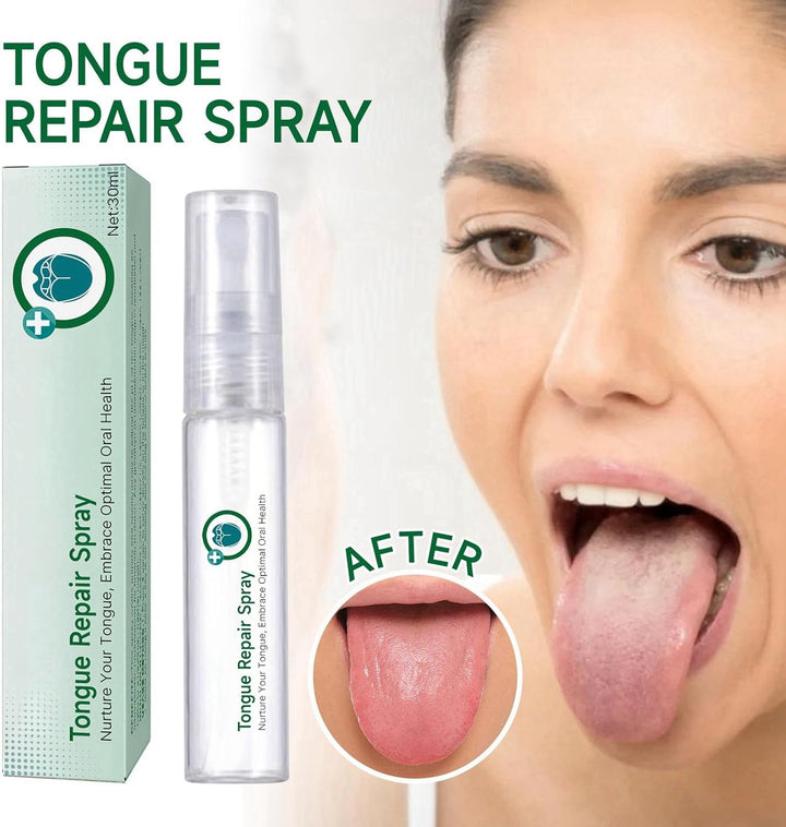 Tongue Repair Spray,Moisturizing Dry Mouth Spray,Fissured Tongue Relief Spray,Instant Dry Mouth Relief,Breath Freshener Spray for Tongue Relief,Tongue Relief Treatment,For White Coating/Bad Breath