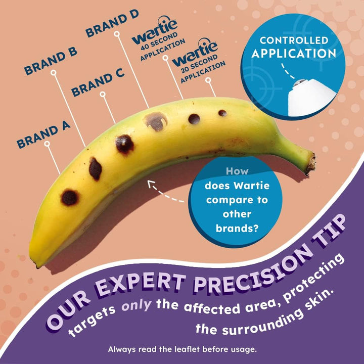 Freeze Wart and Verruca Remover, Safe for Adults and Children Aged 4+, Fast Acting Wart and Verruca Treatment for Hands and Feet, Contains 15 Applications, White, 50 Ml (Pack of 1)