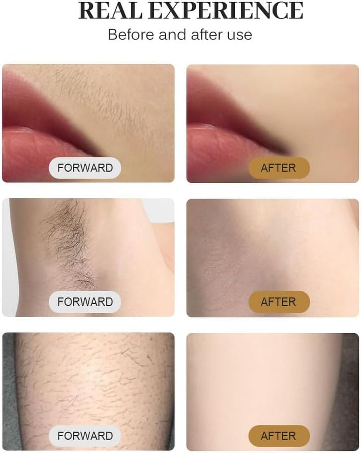 2025 New 808 Diode Laser Hair Removal Machine Triple Wavelength Painless Permanent Portable 808Nm 755Nm 1064Nm