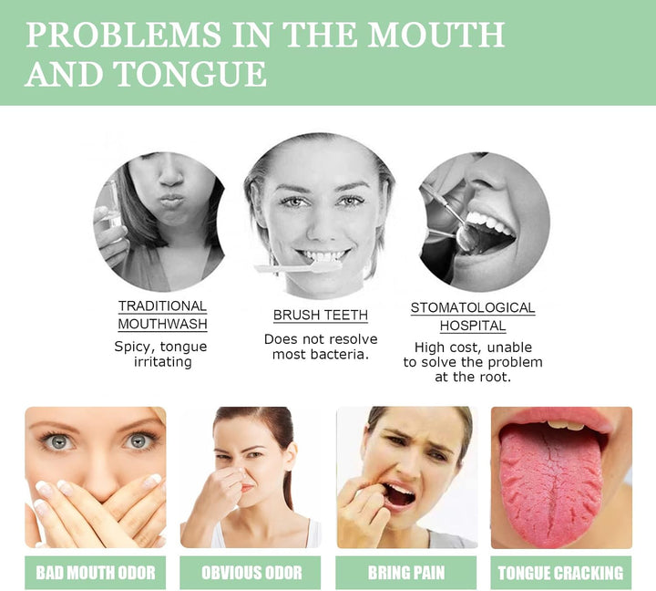 Fissured Tongue Relief Spray,Tongue Repair Spray,Sore Tongue Relief Sore Tongue Relief Mint Breath Spray,Moisturising Dry Mouth Relief Spray,Breath Freshener