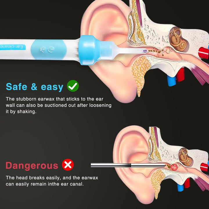 Oroclear Earwax Remover Adult, Electric Oroclear Ear Cleaner Kit Mit 2 Pcs Silicone Replacement Heads