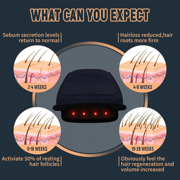 Laser Hair Growth Cap, 84 * 660Nm & 84 * 850Nm Wireless Infrared Red Light Therapy Beret Hat for Damaged Hair Repair, Prevent Hair Loss and Hair Regrowth Women and Men
