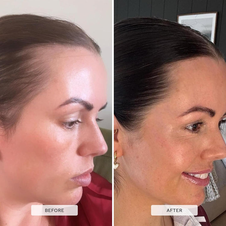 Shampoo and Conditioner Set — SLS Free Hair Growth and Thickening Treatment for Women - Coconut and Avocado Scented - Suitable for All Types, Promotes Strong and Healthy Hair