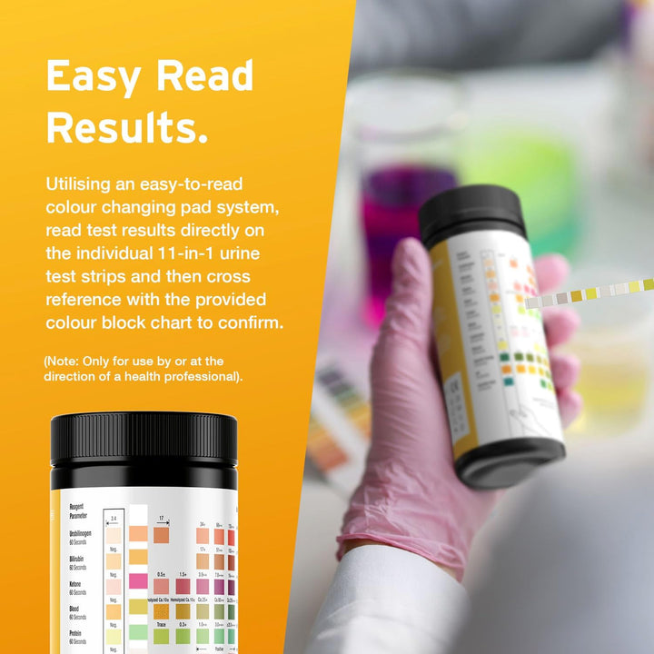 100 X AYDMED 11-In-1 Urine Test Strips | 11 Parameter Urine Test Strips for Urobilinogen, Bilirubin, Ketone, Blood, Protein, Nitrite, Leukocytes, Glucose, Specific Gravity, Ph & Ascorbic Acid