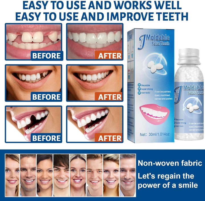 Temporary Tooth Filling,Repair Beads Tooth Filling Repair Kit,False Teeth,Moldable Tooth Repair Kit,Thermal Forming Filling Kit for Teeth,Tooth Repair Granules,Diy Fixing Dental Bridge Repair Kit