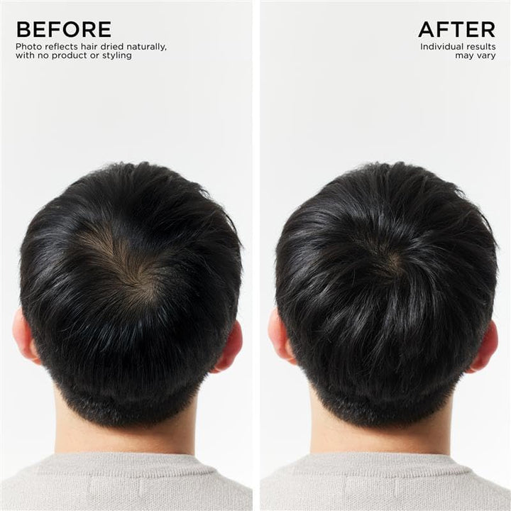 Hair Thickening Conditioner for Hair Loss and Weakening Hair Korean Hair Care Biotin Conditioner Moisturizing Strengthening Colour Protect