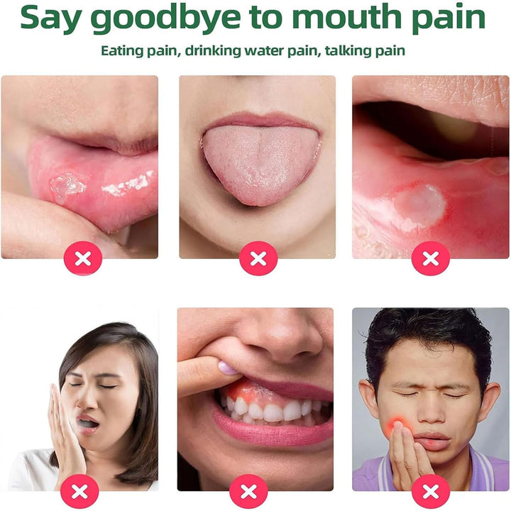 Mouth Ulcer Treatment Spray,Mouth Ulcer Treatment for Adults,Canker Sore Relief Treatment,Herbal Mouths Sprays for Ulcer Treatments,Dry Mouth Relief,Breath Freshener Spray(Pack of 1)