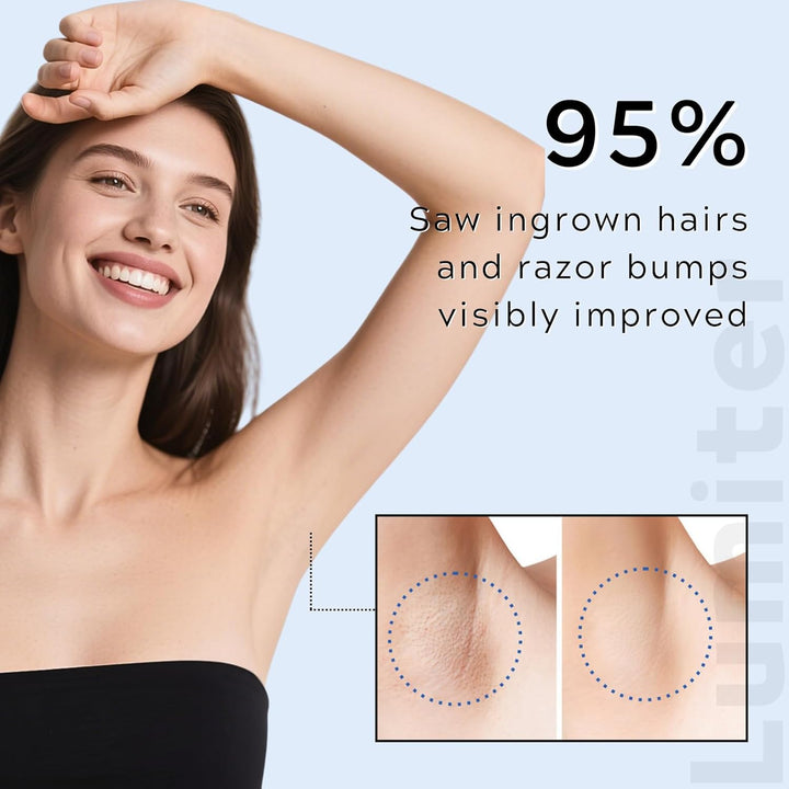 Smoothing Solution Ingrown Hair Treatment, after Shave Soothing Roll on Serum with BHA AHA, Razor Bump & Ingrown Hairs Serum for Men & Women Underarm/Face/Neck/Leg, Tend Skin Solution, 50ML