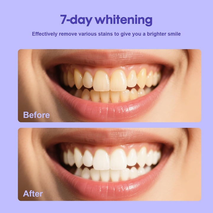 Teeth Whitening Powder - Enamel-Safe & Sensitivity-Free Natural Tooth Whitener for Coffee, Wine, Smoking Tea – Brighten Your Day, 1.7 Oz