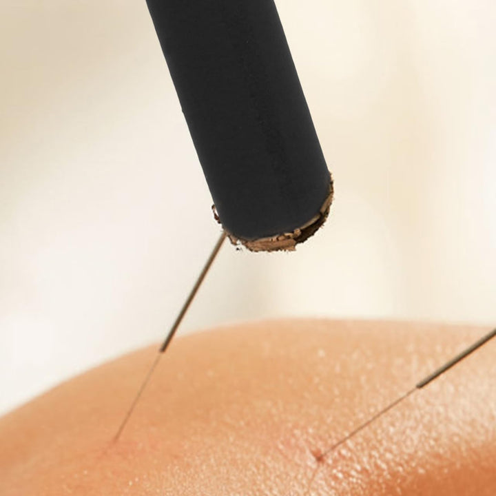 10Pcs Moxibustion Moxa Stick, Moxa Rolls, Moxibustion Sticks Consistent Heat Therapy, Smokeless Traditional Heat Treatment