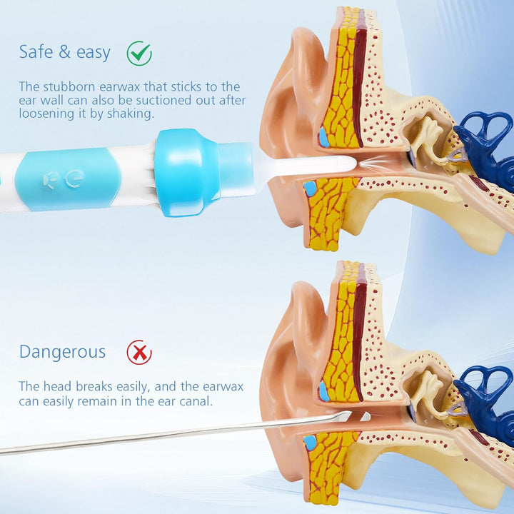 Earwax Remover, Electric Ear Wax Suction Remover, Electric Vacuum Ear Cleaner with Led Light,Ear Wax Removal Kit for Adults and Children,Includes 2 Silicone Replacement Heads,Built-In Battery