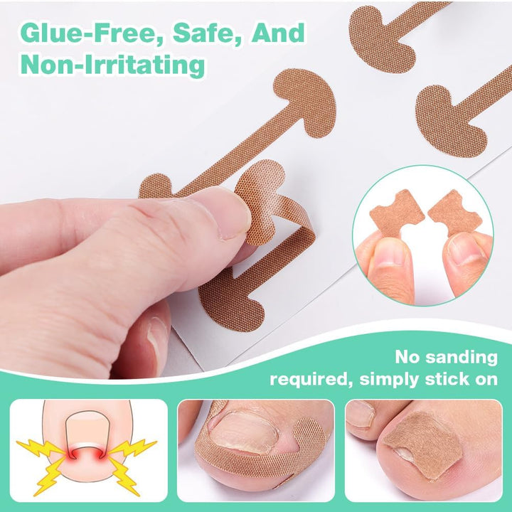 Ingrown Toenail Removal Kit, Ingrown Toenail-Corrector Tools with Podiatry-Toenail Braces, Silicone Toe Strap, Toenail Straightener Strips and Patch for Toe Pain Relief