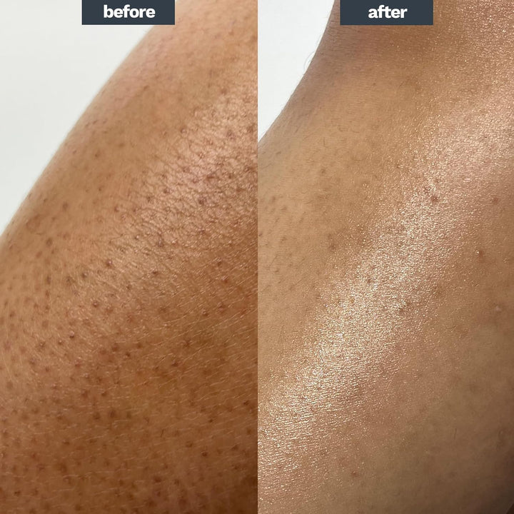 Softening Bath Milk Oil 250Ml | Lab6, Collodial Oat, Lactic Acid | Dermatologically Tested