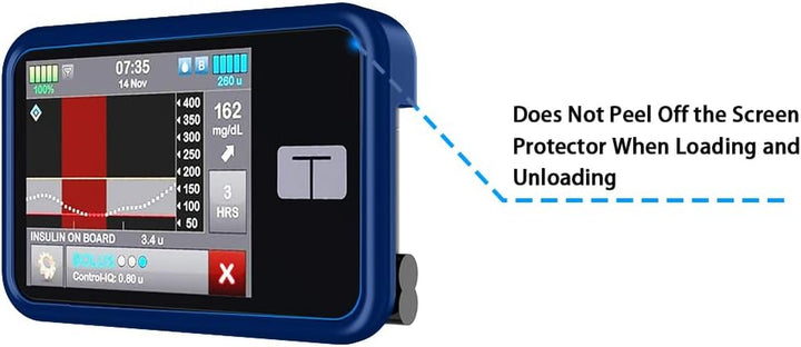 Protective Case for Tandem T:Slim X2 Pump with Built-In Metal Belt Clip (Strong & Durable Case for Tandem Diabetes Care Tslim X2 Insulin Pump) - Blue