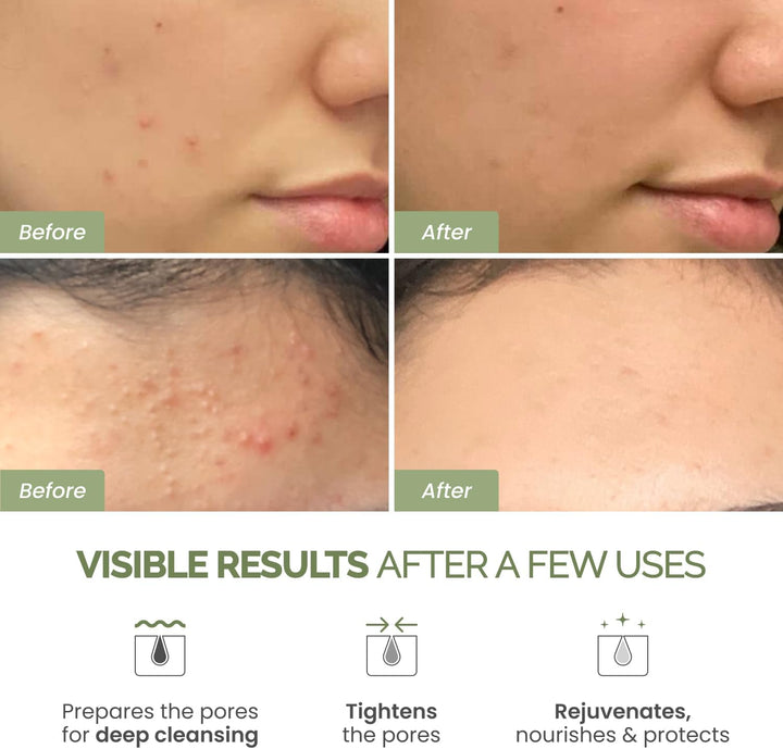 Korean Skincare Face Mask – Organic Clay Mask with Avocado & Green Tea, Vegan & Dermatologically Tested Mud Mask for Face & Body – 100G/3.4 Oz