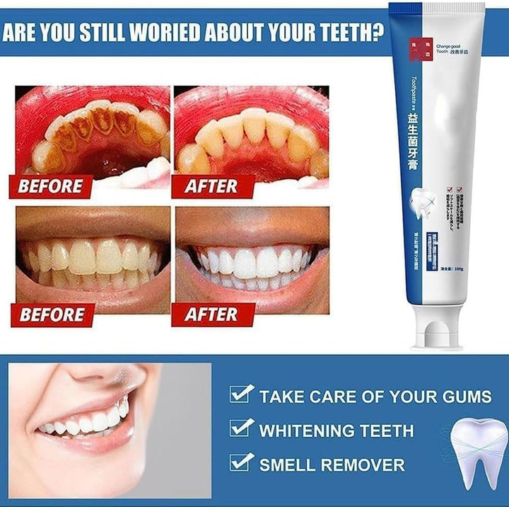 Probiotic Toothpaste, Probiotic Whitening Toothpaste, Protects Tooth Enamel, Freshens Breath, Fluoride-Free Formula, Removes Stains, Suitable for Adults and Children