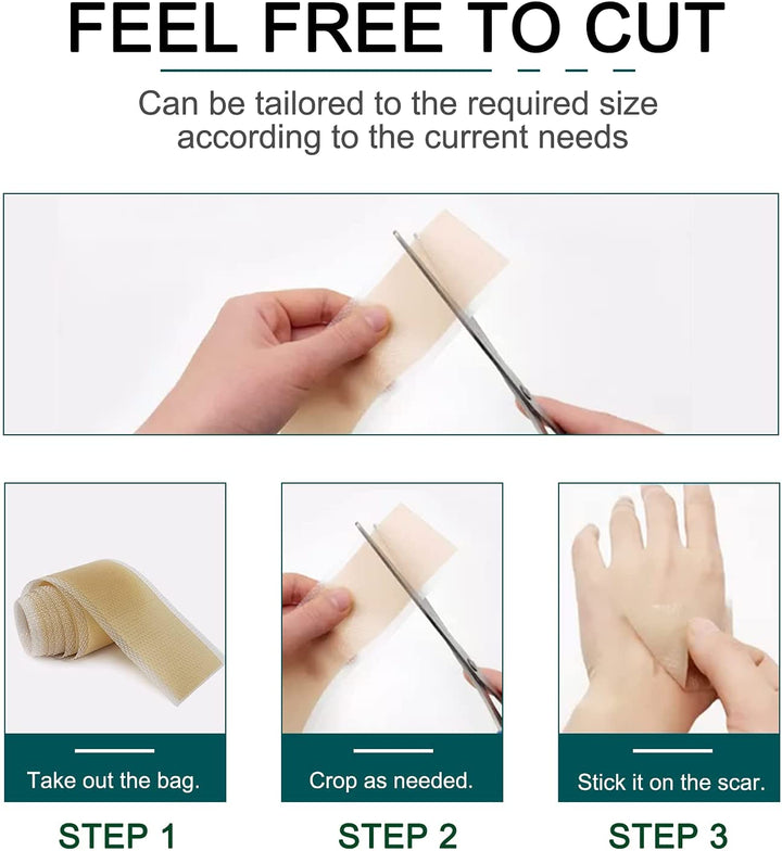 Silicone Scar Sheets, Silicone Scar Tape (1.6” X 120”Roll-3M), Scar Tape Roll Medical Silicone Easy-Tear Gel Tape Roll, Scar Removal Sheets Works on Old & New Scars, Scar Treatment Sheets