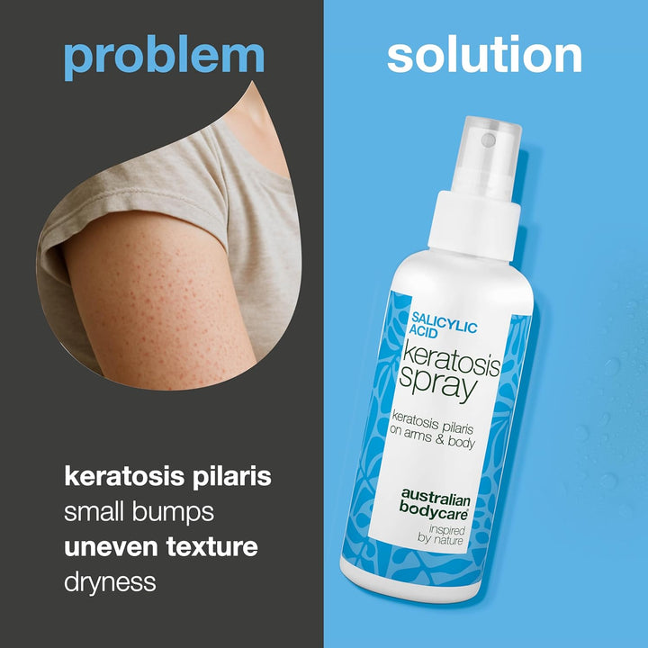 Keratosis Pilaris Spray Treatment for Strawberry Legs, Chicken Skin & Bumpy Arms – with 2% Salicylic Acid, Glycolic Acid, Glycerin & Panthenol