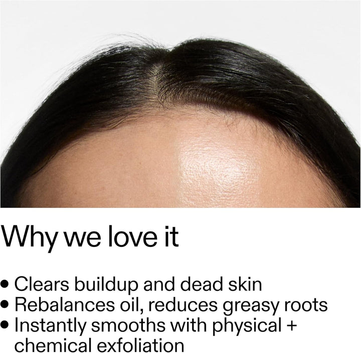 7% Glycolic Acid Exfoliating Scalp Scrub 150Ml, Removes Product Build Up, Hair Growth, Fragrance Free, Suitable for All Hair Types