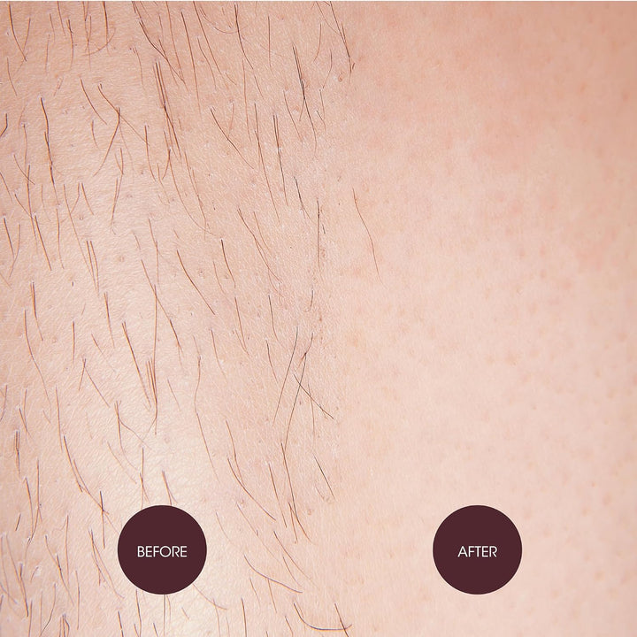 Brazilian & Bikini Wax Kit, Strip Free Hard Wax, Intimate Waxing Kit, Includes 3 Wooden Spatulas, 3 X Oil Wipes & Hot Wax 140G