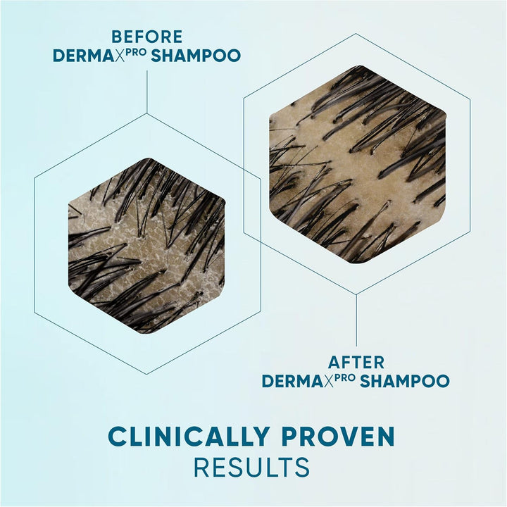 Dermaxpro Soothing Comfort anti Dandruff Shampoo 500Ml with Aloe Vera Extract and Ceramide Complex. Soothes Dry, Itchy Scalp and Helps Reinforce the Skin Barrier