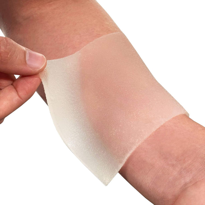 Emergency Burn Dressing 10X10Cm Pack of 5 - Cools, Soothes and Relieves Pain