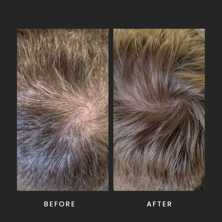 Caffeine Shampoo for Men, Support and Encourage Healthy Hair Growth with Caffeine, Panthenol and Vitamin E, Sulphate Free, Natural, Vegan, Cruelty Free, 500 Ml