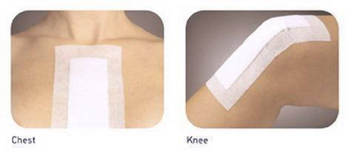 99XX0097 Dressing, 6Cm X 7Cm, Pack of 60, White