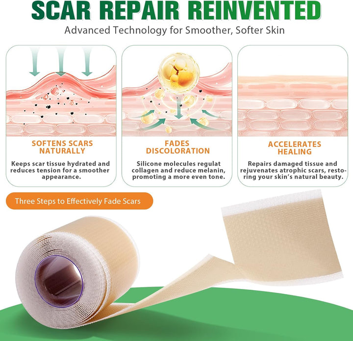 Silicone Scar Tape, Silicone Scar Sheets(1.6" X 75" Roll-1.9M), Medical Grade Scar Tape, Reusable Silicone Tape for Surgical Scar, C-Section, Keloid