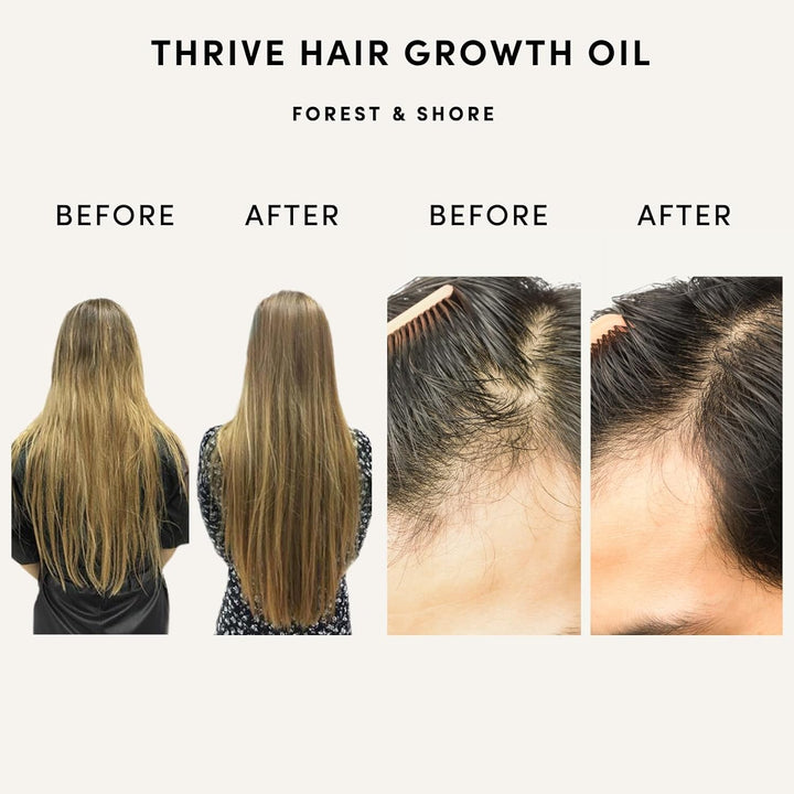 Hair Growth Oil 100% Natural Hair Oil with Caffeine, Biotin, Castor Oil, Argan Oil, Coconut Oil, and Rosemary Oil Effective Thickening Mask & Hair Loss Treatment