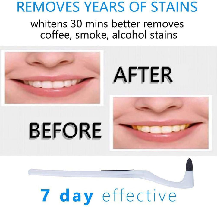 Teeth Tartar Remover, Professional Tooth Stain Eraser, Teeth Polishing Cleaning Kit Removes Plaque & Impurities Whitening Oral Hygiene Care Tool - (2 Pack, White & Blue)