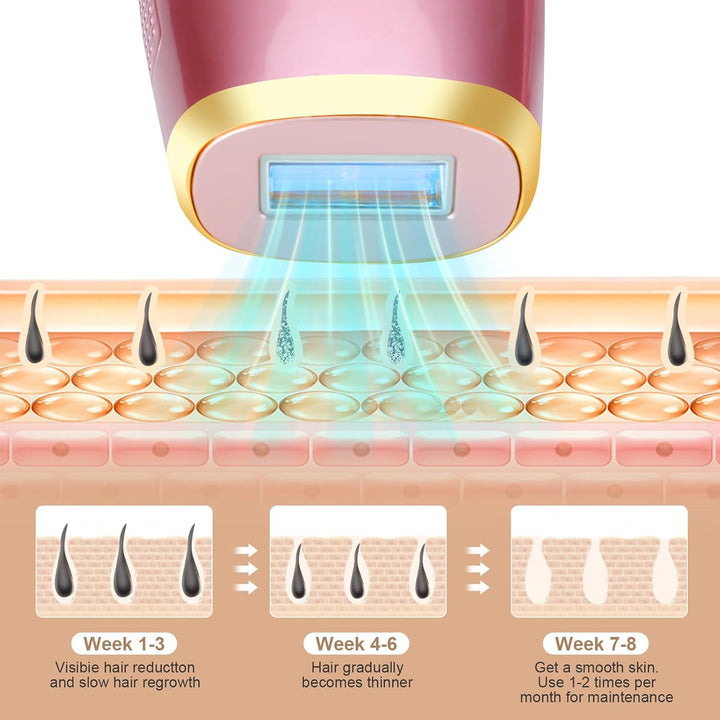 IPL Laser Hair Removal Device for Women, Ice-Cooling Painless Permanent IPL Hair Removal, 999,990 Flashes for Legs Arms Armpit Body Bikini, at Home Handheld Laser Hair Remover Epilator