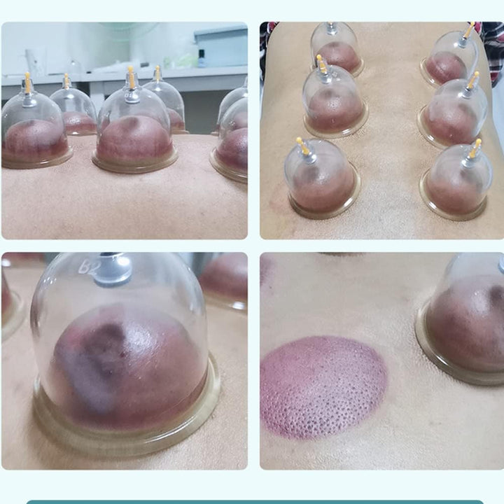 26 Cupping Cups Sets Biomagnetic Traditional Professional Chinese Therapy Massage Vacuum Cupping Set Household Pull Out Cupping Kit/Hijama Chinese Massage Suction