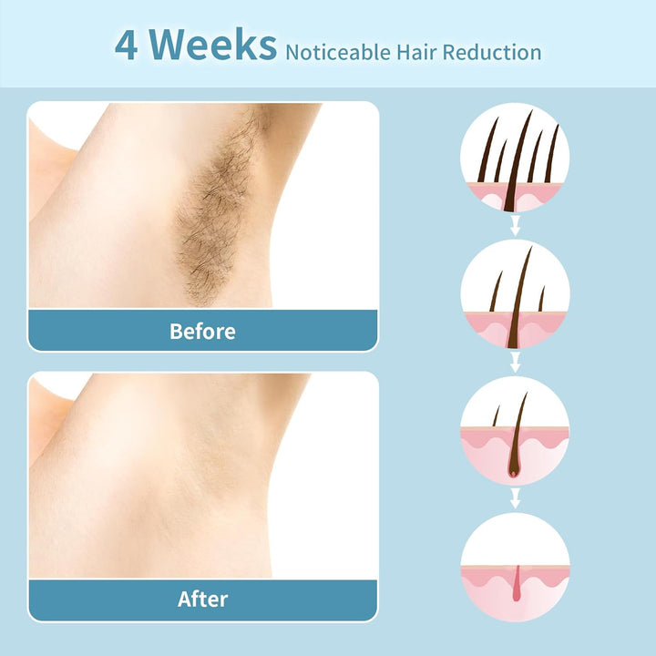 Laser Hair Removal Device, 3 in 1 Beauty Salon Grade Home Hair Remover Device with Cooling System, IPL Body Painless Laser Hair Removal for Face Armpits Arms Legs Bikini Line