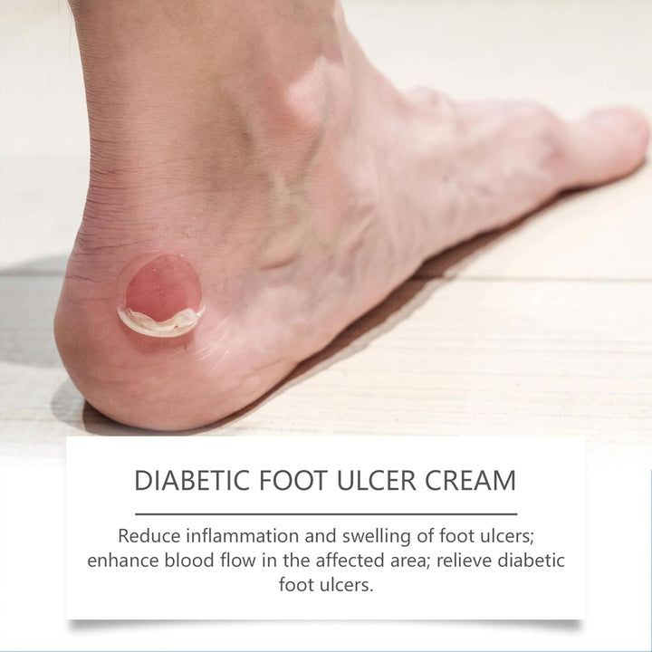 Diabetic Foot Cream 20G, Professional Feet Cream for Diabetic Feet, Foot Moisturise and Soothing Itching, Suitable for Diabetics
