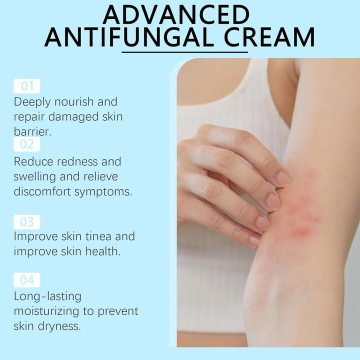 Antifungal Cream - anti Fungal Skin Cream - Ringworm, Jock Itch, Eczema, Tinea Versicolor, Athletes Foot Treatment - Fast Acting & Gentle Safe & Soothing Hydrating Formula