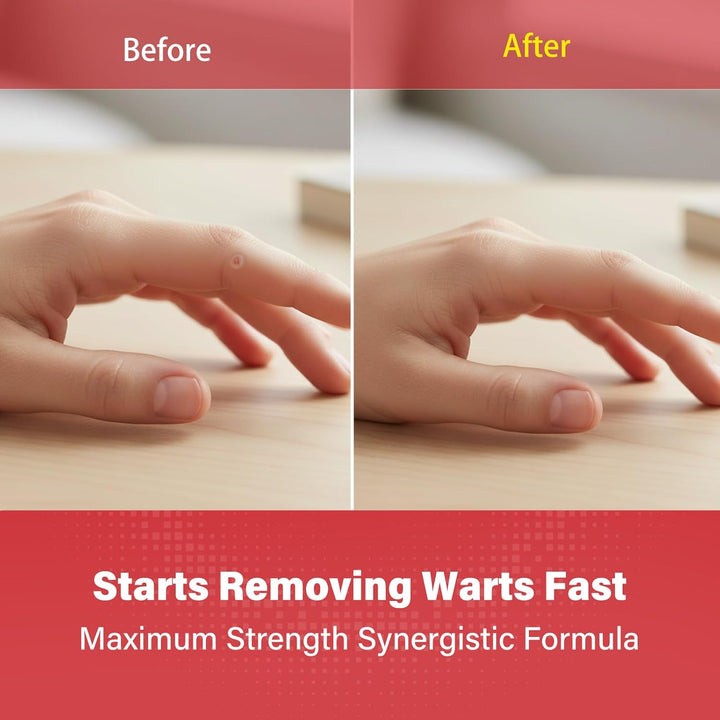 Wart Remover Pads 24-Count, Maximum Strength Wart Removal Plaster, 2 Sizes Core (6 Mm & 10 Mm) for Common & Plantar Warts