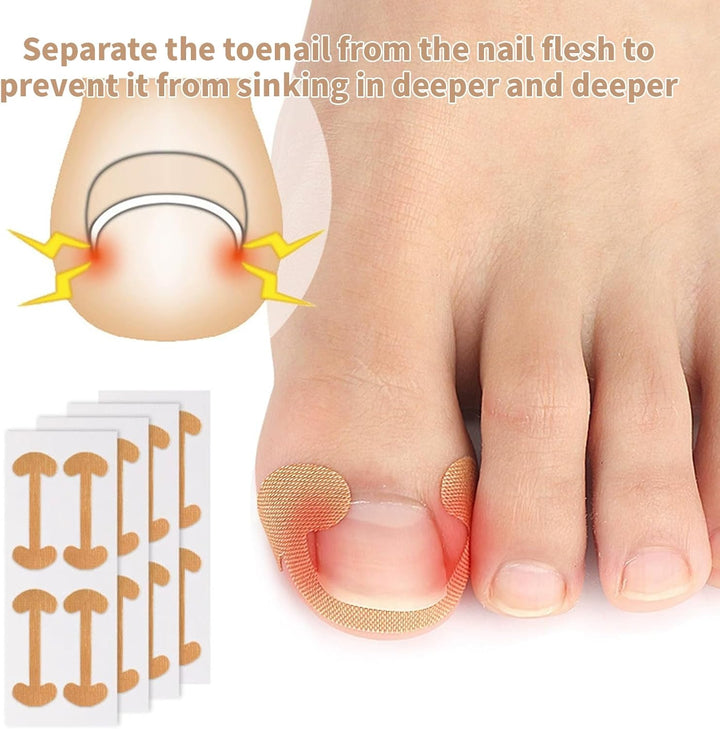 2 Types Ingrown Toenail Treatment Patch with Ingrown Toenail Tool for Toenail Care Protect Toe Nail