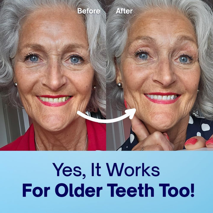 Dentist-Approved Teeth Whitening Powder - Indybest Award-Winner - Enamel-Safe & Sensitivity-Free - Cool Mint Flavour - Removes Years of Stains - 6 Month Teeth Whitener Supply