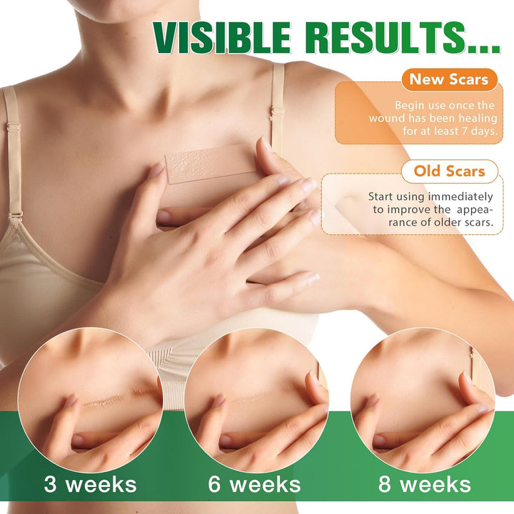 Silicone Scar Tape, Silicone Scar Sheets(1.6" X 75" Roll-1.9M), Medical Grade Scar Tape, Reusable Silicone Tape for Surgical Scar, C-Section, Keloid