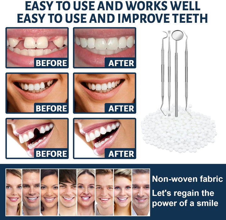 Tooth Repair Kit - Temporary Fake Teeth Replacement Kit with Dental Mirror Tools for Temporary Restoration of Missing & Broken Teeth Replacement Dentures
