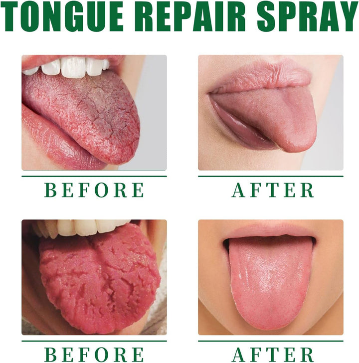 3PCS Dry Mouth Spray,Tongue Moisturizing Spray,Instant Dry Mouth Relief,Tongue Repair Spray,Fissured Tongue Relief Spray,Fresh Breath Spray,Remove Odor,Natural Ingredients,Alcohol Free(30Ml)