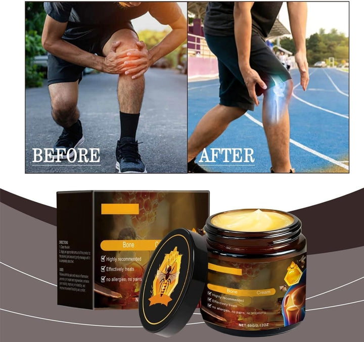 Bee Ve/Nom Jo/Int and Bone Pain Relief Cream,Bee Ve/Nom Treatment Cream,Pain Relief Cre/Am,Be/E Ven/Om Cre/Am for Arth/Ritis,Be/E Ven/Om Jo/Int Relief Moisture Cre/Am,Arth/Ritis Pa/In Re/Lief