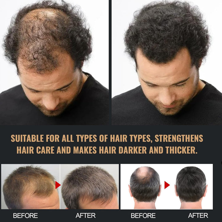 2Pcs Root Activator Shampoo,Mane Root Activator Shampoo for Man,Unisex Hair Thickeningshampoo That Repairs,Smooths & Strengthens,Hair Restoration Solution